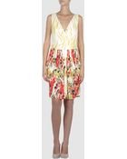 Normaluisa Short Dress - Lyst