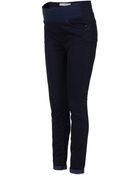 Topshop Moto Leigh Skinny Maternity Jeans - Lyst