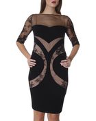 Blumarine Dress Woman - Lyst