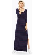 Amour Vert Yolanda Dress - Lyst