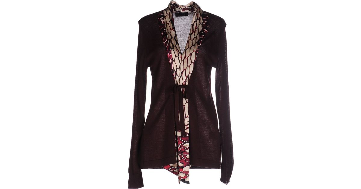 Clips Cardigan in Black Lyst